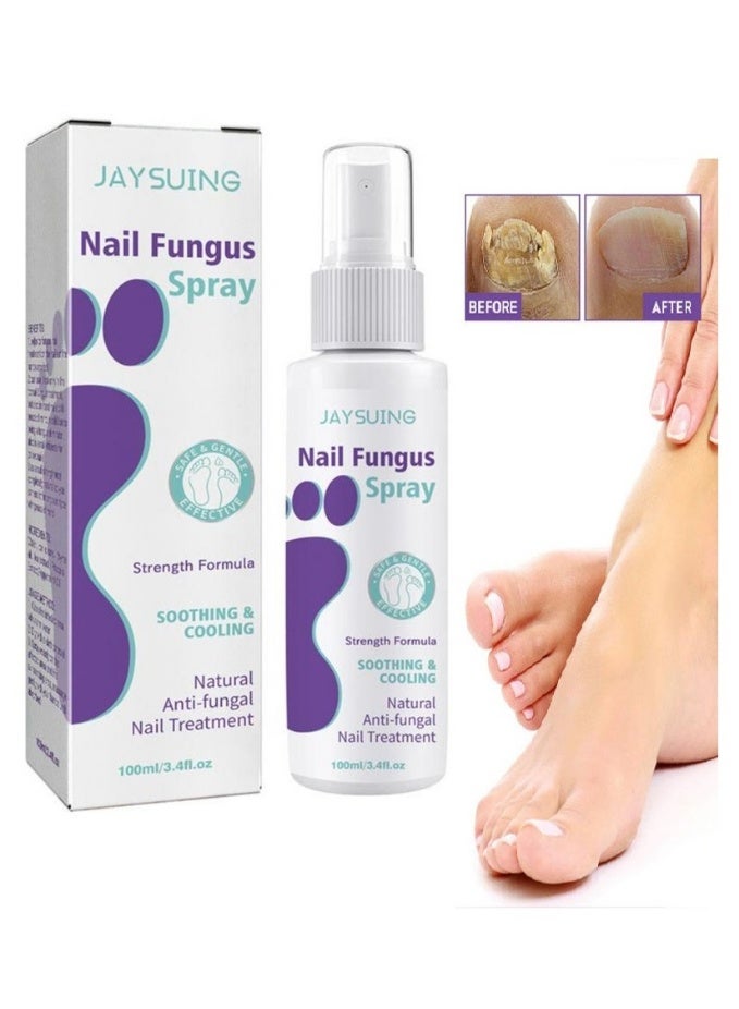 Jaysuing 1-Piece Fungus Spray, Nail Fungus Treatment For Toenail And Nail Strengthener - Image 1