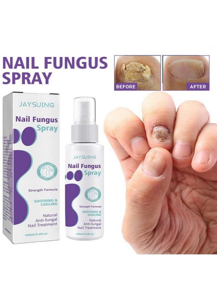 Jaysuing 1-Piece Fungus Spray, Nail Fungus Treatment For Toenail And Nail Strengthener - Image 3