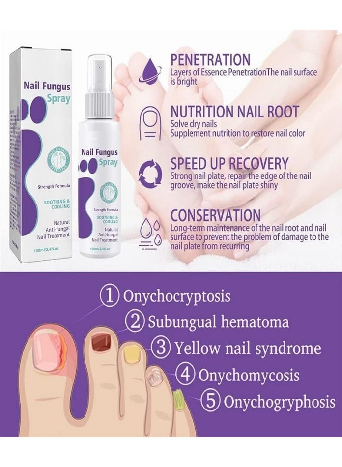 Jaysuing 1-Piece Fungus Spray, Nail Fungus Treatment For Toenail And Nail Strengthener - Image 4