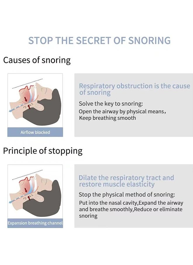 Anti Snoring Device, Reduce Snoring Solution, Comfortable Nasal Dilators to Relieve Snore for Better Sleep Sleeping Aid Sleep 8 Pack