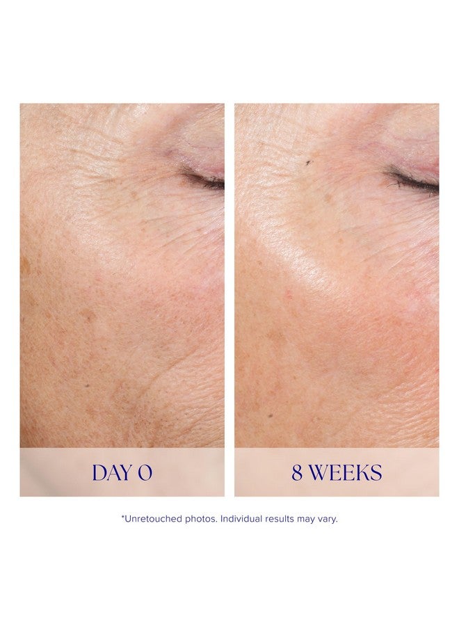 آي إس كلينيكال نظام التقشير النشط iS CLINICAL، نظام تقشير لطيف في المنزل من خطوتين لتقشير الوجه - Image 4