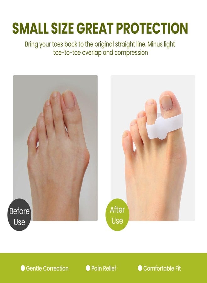 Bukihome Toe Separators Bunion Corrector - 8 Pack Big Toe Spacers with 2 Loops, Suitable for Bunion and Overlapping Toes, Reduce Foot Pain(White) - Image 2
