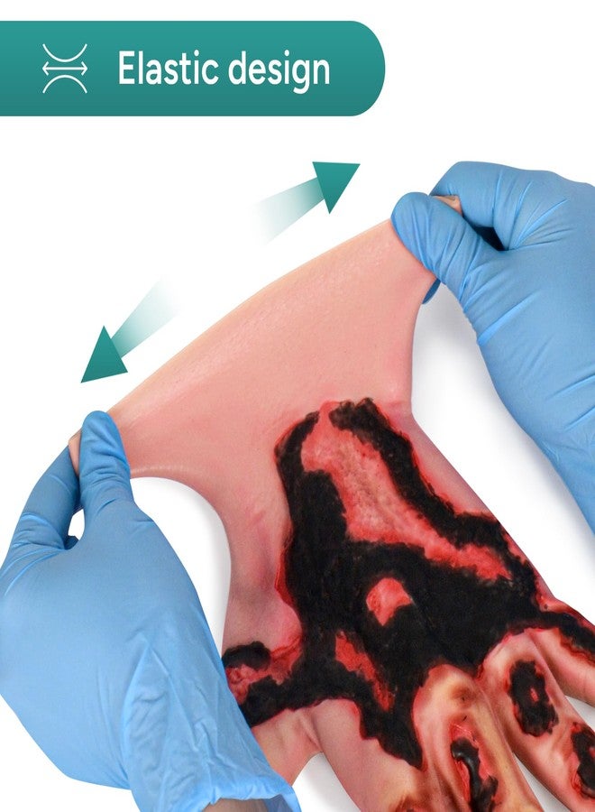 MedEduQuest Burn Wound Packing Trainer, Simulated Burn Wound Model for Wound Care Training, Wearable Silicone Hand Burn Wound Trainer for Medical Education - Image 2