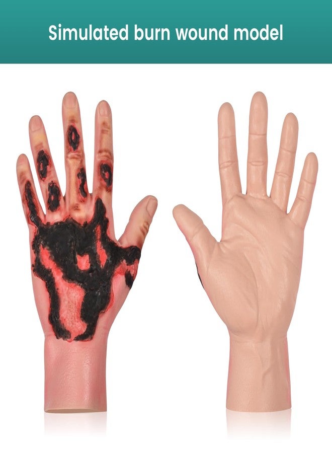 MedEduQuest Burn Wound Packing Trainer, Simulated Burn Wound Model for Wound Care Training, Wearable Silicone Hand Burn Wound Trainer for Medical Education - Image 3