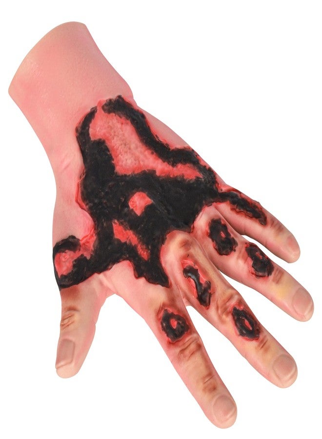 MedEduQuest Burn Wound Packing Trainer, Simulated Burn Wound Model for Wound Care Training, Wearable Silicone Hand Burn Wound Trainer for Medical Education - Image 1