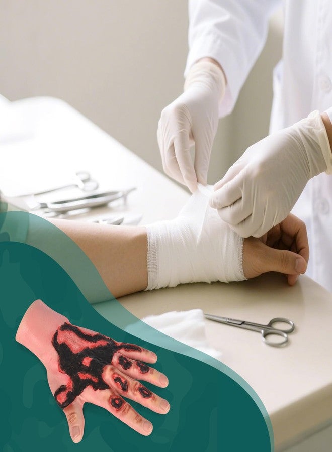 MedEduQuest Burn Wound Packing Trainer, Simulated Burn Wound Model for Wound Care Training, Wearable Silicone Hand Burn Wound Trainer for Medical Education - Image 5