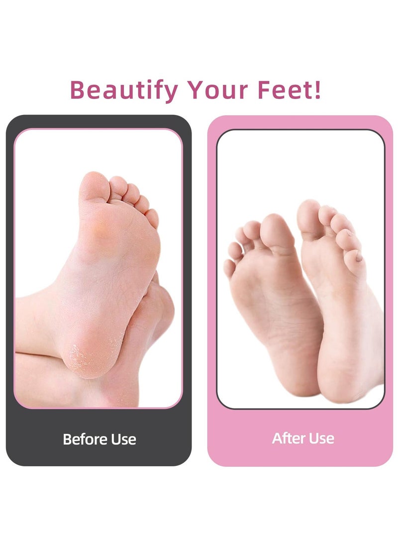 جهاز كهربائي لإزالة مسامير القدم بطول 4.8 بوصة، مزيل مسامير القدم الاحترافي من الألومنيوم مع 80 قرص صنفرة، أدوات باديكير للتحكم في السرعة بدون خطوات لإزالة مسامير القدم الميتة (وردي وردي) - Image 5