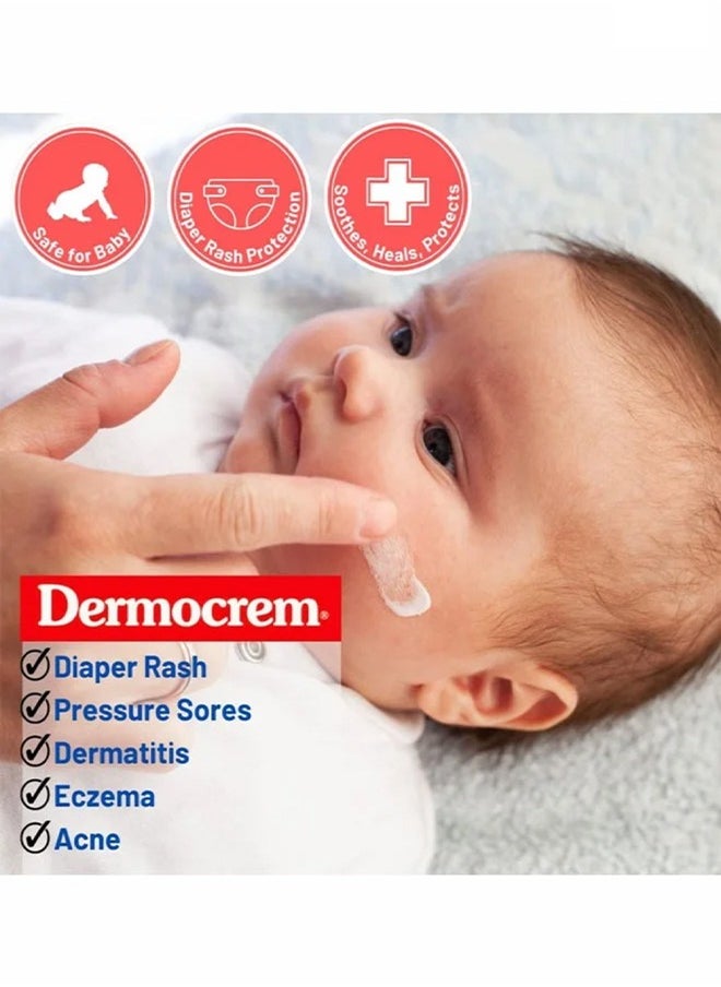 Sudocrem Antiseptic Healing Cream -To Protect Rash And Surface Wound For Baby ,Soothes, Heals, And Protects, Relief And Treatment Of Diaper Rash, Developed To Provide Optimal Hydration And Moisturisation 125g  - Image 3