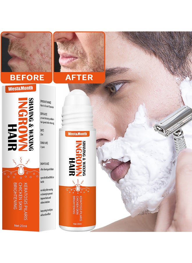 West&Month Ingrown Hair Essence Brightening Skin Get Rid Of Beard Nursing Essential Oils, Repairing Serum To Reduce Dark Spots After Shaving Gentle On Ingrown Hair  - Image 1