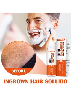 West&Month Ingrown Hair Essence Brightening Skin Get Rid Of Beard Nursing Essential Oils, Repairing Serum To Reduce Dark Spots After Shaving Gentle On Ingrown Hair  - Image 2