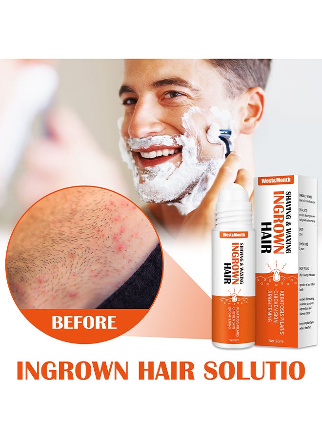 West&Month Ingrown Hair Essence Brightening Skin Get Rid Of Beard Nursing Essential Oils, Repairing Serum To Reduce Dark Spots After Shaving Gentle On Ingrown Hair  - Image 2
