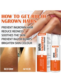West&Month Ingrown Hair Essence Brightening Skin Get Rid Of Beard Nursing Essential Oils, Repairing Serum To Reduce Dark Spots After Shaving Gentle On Ingrown Hair  - Image 4