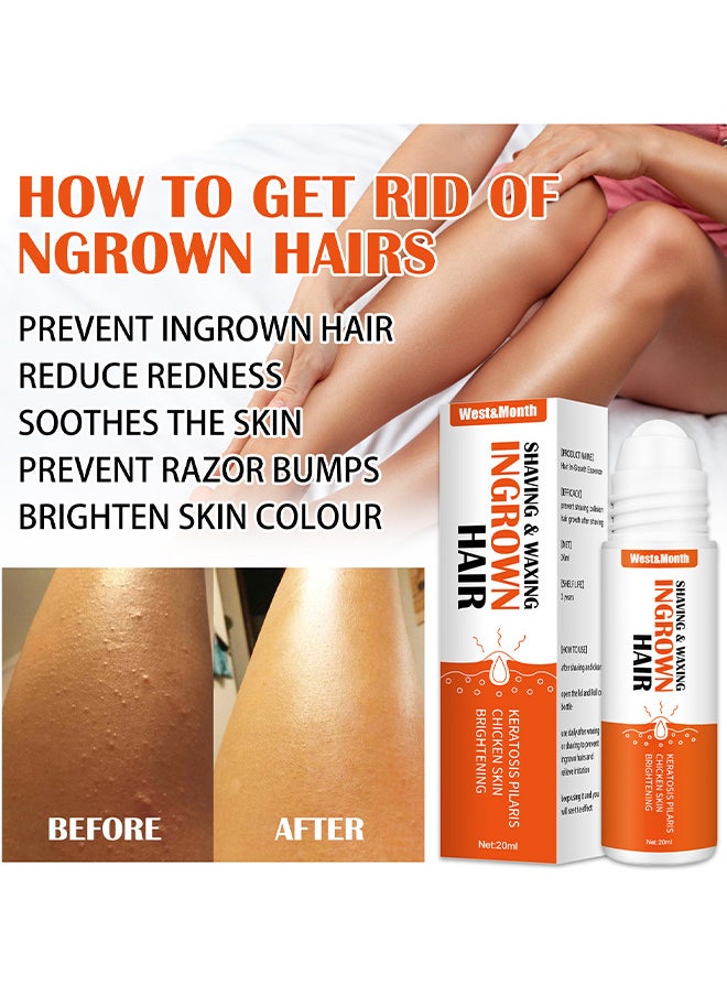 West&Month Ingrown Hair Essence Brightening Skin Get Rid Of Beard Nursing Essential Oils, Repairing Serum To Reduce Dark Spots After Shaving Gentle On Ingrown Hair  - Image 4