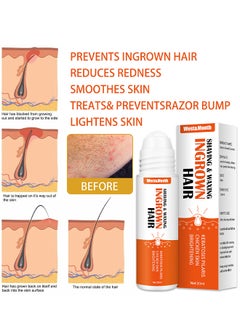 West&Month Ingrown Hair Essence Brightening Skin Get Rid Of Beard Nursing Essential Oils, Repairing Serum To Reduce Dark Spots After Shaving Gentle On Ingrown Hair  - Image 5