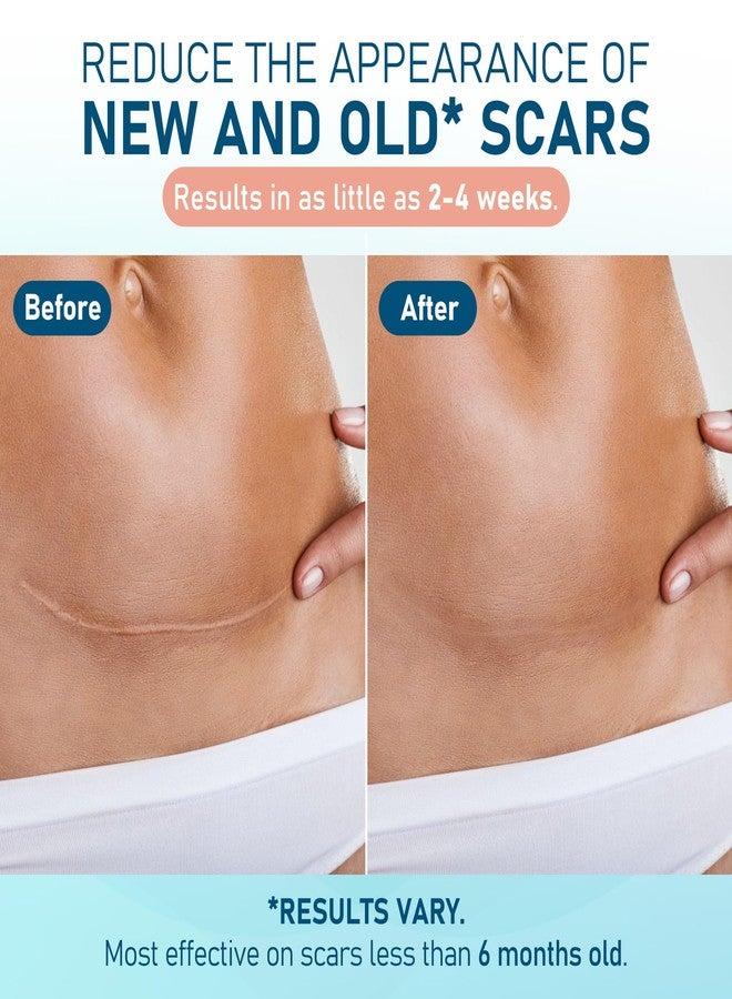 MEDLOT صفائح سيليكون ميدلوت لعلاج الندبات، كبيرة، 10 قطع، 4 بوصات × 7 بوصات لكل قطعة، شريط سيليكون طبي لعلاج الندبات، رقع ندبات الولادة القيصرية، والندبات الجدرية، وعلامات التمدد، والحروق، وحب الشباب، وإزالة الندبات الجراحية - Image 3