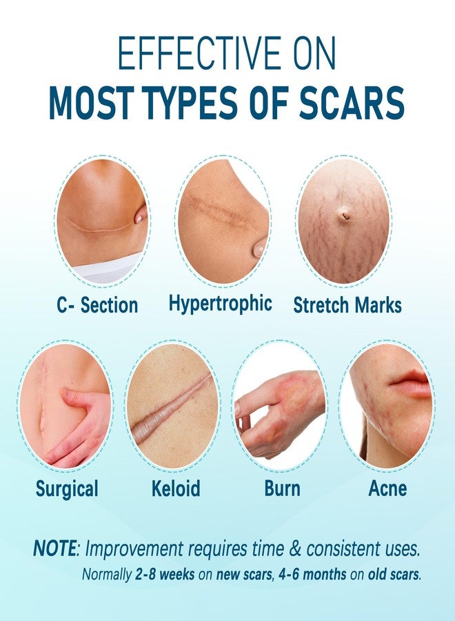 MEDLOT صفائح سيليكون ميدلوت لعلاج الندبات، كبيرة، 10 قطع، 4 بوصات × 7 بوصات لكل قطعة، شريط سيليكون طبي لعلاج الندبات، رقع ندبات الولادة القيصرية، والندبات الجدرية، وعلامات التمدد، والحروق، وحب الشباب، وإزالة الندبات الجراحية - Image 5