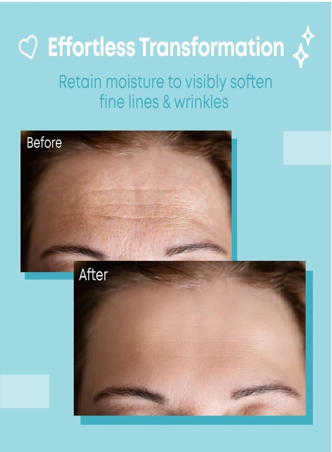 Bayside Forehead Wrinkle Patches Reusable | Non-Invasive Wrinkle Treatment for Fine Lines | Works with Face Lift Tape and Eye Patch Kits | Long-Lasting, Gentle Skin Care Solution | Includes Storage Tin - Image 2