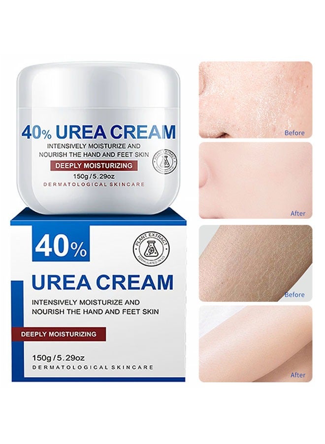 YURHERSU 40٪ كريم اليوريا للكعب الجاف المتشقق أفضل مزيل مسمار للقدمين واليدين يرطب طبيعي يغذي وينعم البشرة الميتة الخشنة المتشققة كريم إصلاح اليدين والقدمين150g - Image 1