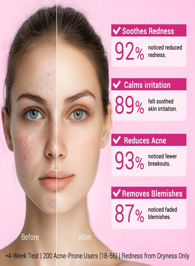 CHANGARLOAD 14% Azelaic Acid Facial Serum with Niacinamide & Hyaluronic Acid – Helps Calm Redness,Improve Blemishes & Dark Spots,Gentle Care for Sensitive Skin,40ml / 1.4 fl oz - Image 4