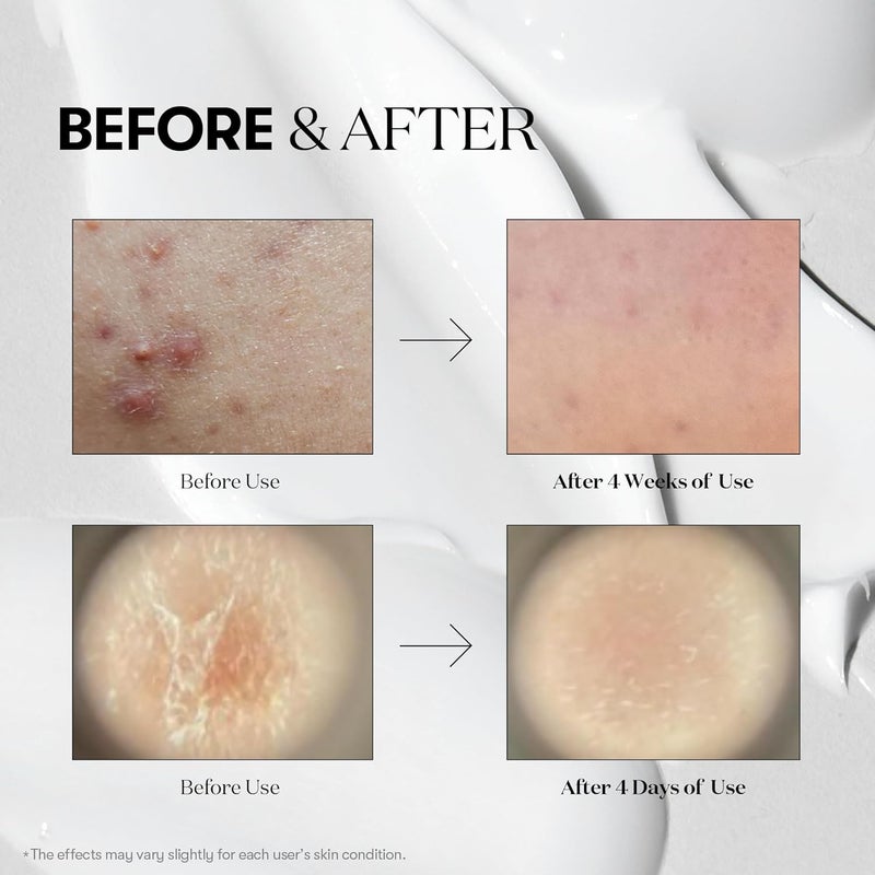 VT COSMETICS Reedle Shot 700 Essence 30ml | High-Strength Reedle Micro-Needle Serum for Pores, Rough Texture & Smooth Skin - Image 5