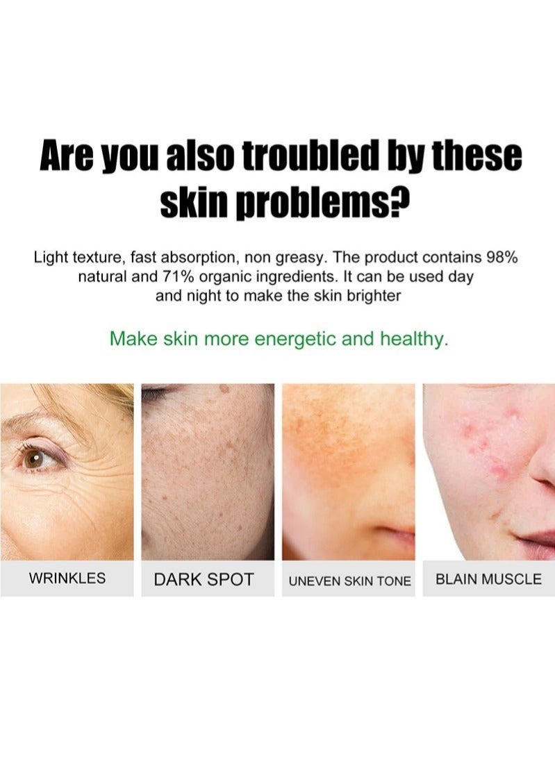 إيلهو كريم تبييض النمش، كريم إزالة التصبغ للوجه، كريم مزيل النمش، كريم مرطب مضاد للعيوب، مزيل البقع الداكنة لتبييض البشرة (كريم النمش) - Image 2