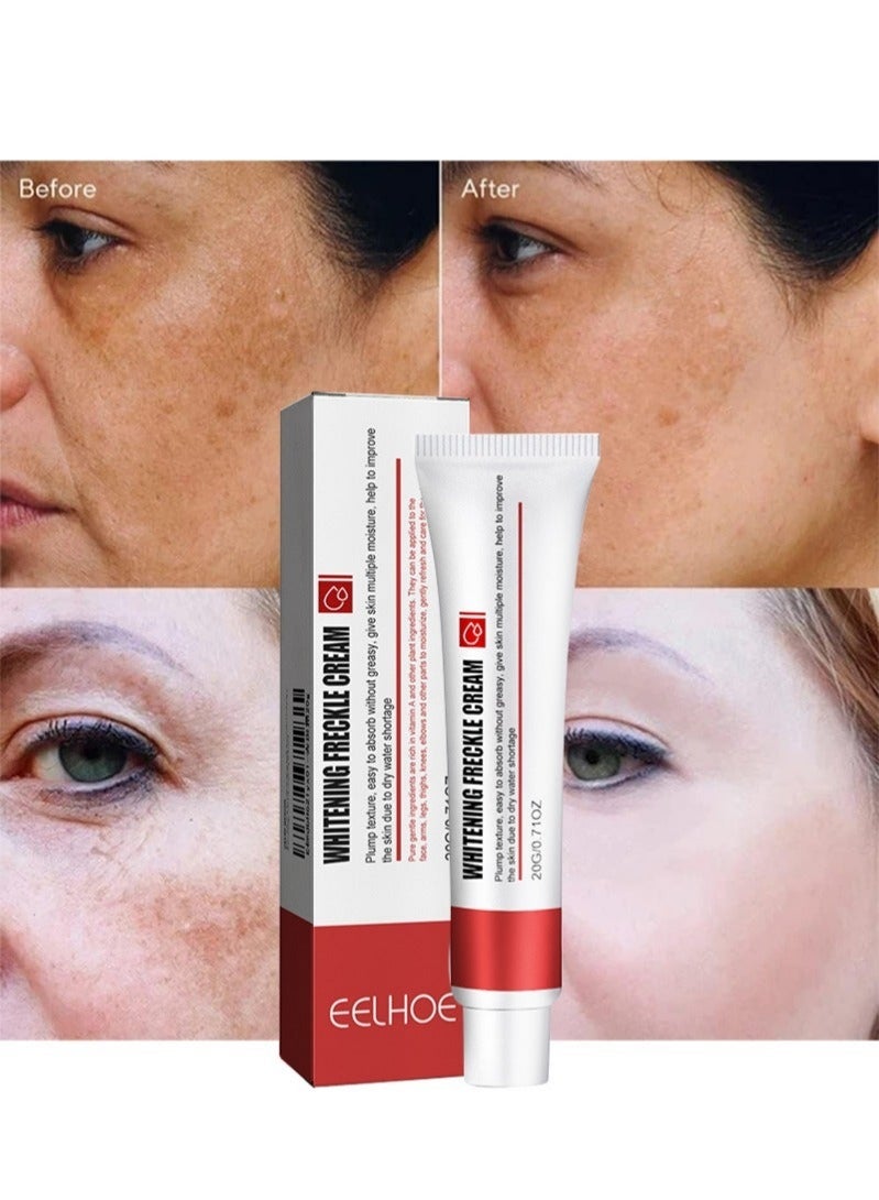 إيلهو كريم تبييض النمش، كريم إزالة التصبغ للوجه، كريم مزيل النمش، كريم مرطب مضاد للعيوب، مزيل البقع الداكنة لتبييض البشرة (كريم النمش) - Image 1