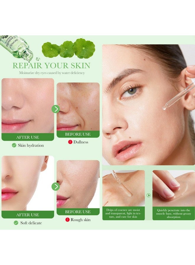 بيو أكوا مصل كينتيللا اسياتيكا لإصلاح وتلطيف الوجه، مغذي للتحكم في الزيوت، مضاد لحب الشباب، العناية ببشرة الوجه، 30 مل / 1 أونصة سائلة - Image 4