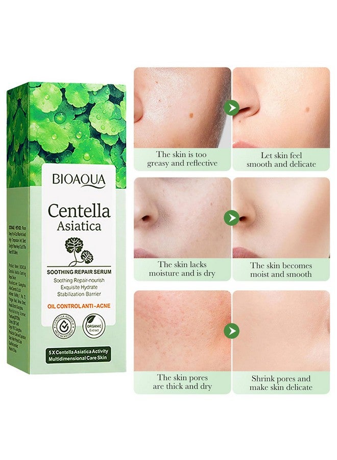 بيو أكوا مصل كينتيللا اسياتيكا لإصلاح وتلطيف الوجه، مغذي للتحكم في الزيوت، مضاد لحب الشباب، العناية ببشرة الوجه، 30 مل / 1 أونصة سائلة - Image 2
