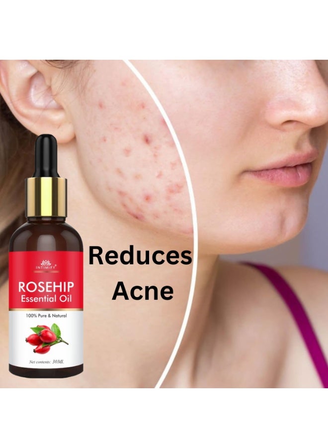 INTIMIFY زيت الأوكالبتوس العطري وزيت ثمر الورد العطري من إنتيميفاي، 30 مل × 2 - Image 3