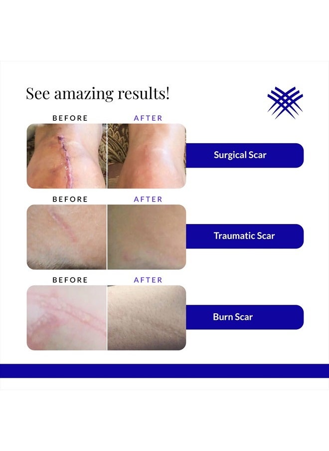 Rejuvaskin - Rejuvasil Silicone Scar-Gel, 0.33 Ounce - Image 1