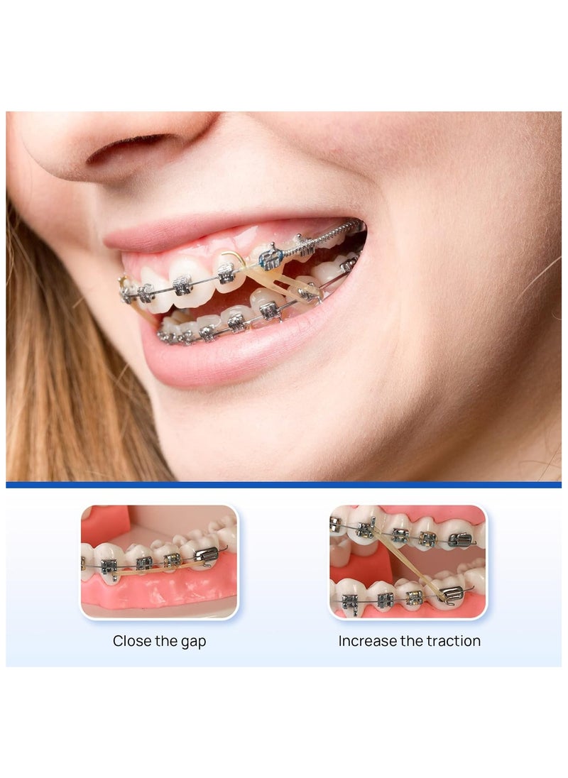 Orthodontic Elastics Bands 1/4 Medium (6.4 mm) 100 Elastics