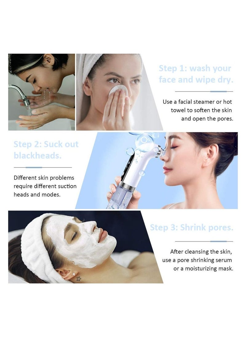Generic - Blackhead Remover Pore Vacuum - Electric Blackhead Vacuum Cleaner Blackhead Extractor Tool Device Comedo Removal Suction Beauty Device - Image 1