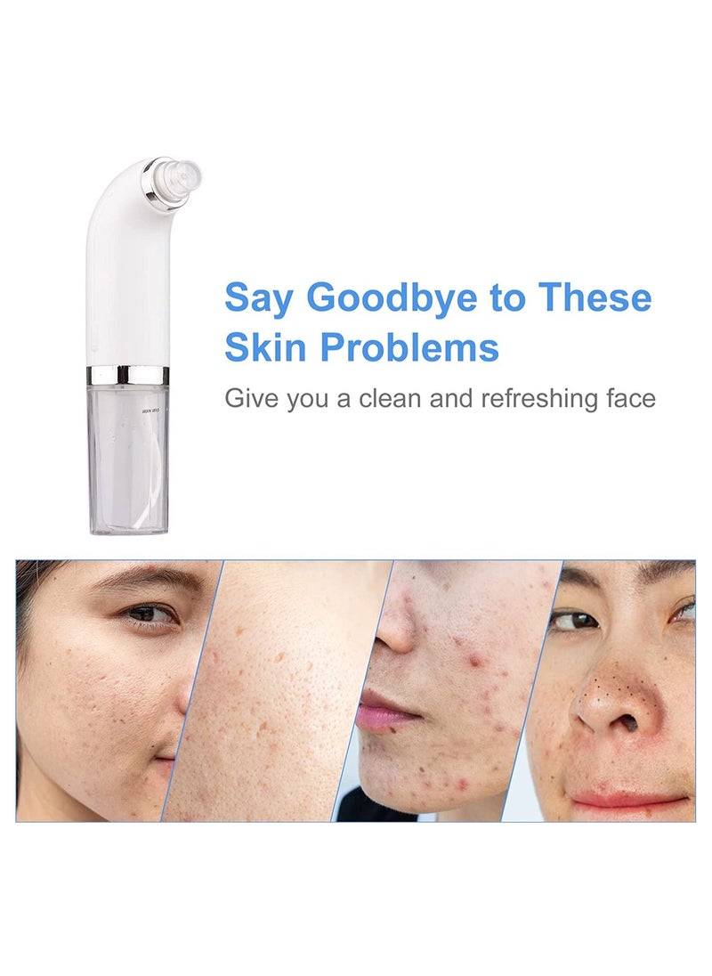Generic - Blackhead Remover Pore Vacuum - Electric Blackhead Vacuum Cleaner Blackhead Extractor Tool Device Comedo Removal Suction Beauty Device - Image 1