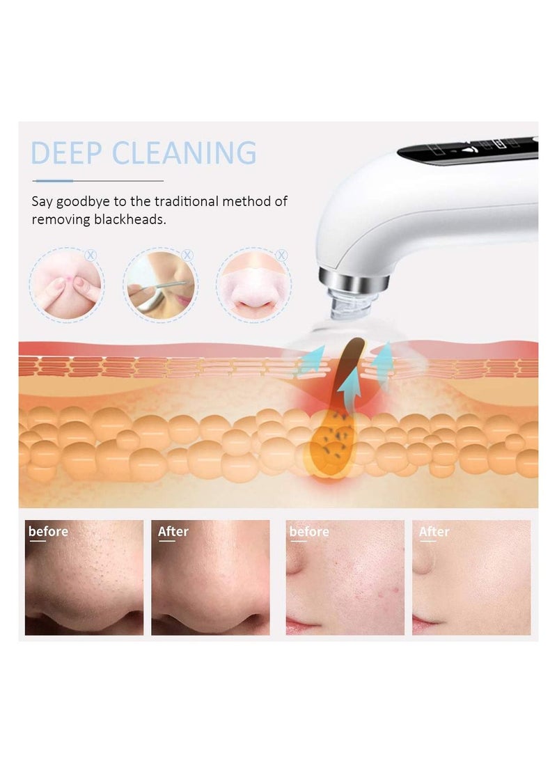 Generic - Blackhead Remover Pore Vacuum - Electric Blackhead Vacuum Cleaner Blackhead Extractor Tool Device Comedo Removal Suction Beauty Device - Image 1