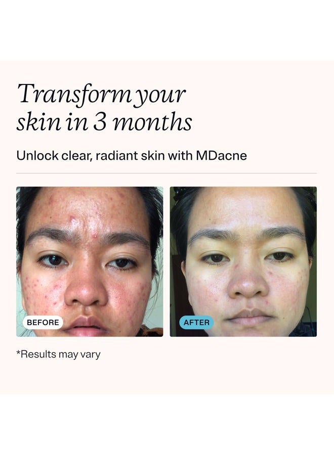 MDacne مجموعة علاج حب الشباب بخطوات 3 - كريم بنزويل بيروكسايد 2.5%، منظف حمض الساليسيليك، مرطب نياسيناميد – مجموعة طبية نباتية لعلاج حب الشباب للبالغين والمراهقين، مجموعة حب الشباب لمدة 30 يومًا - Image 3