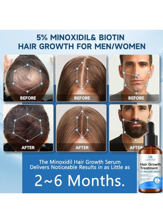 LANEMAY Minoxidil Hair Growth Serum, Advanced Hair Fall Control Serum with Minoxidil 5%, Biotin, Rosemary & Vitamin E, Anti-Hair Loss & Strengthening 30ml - Image 2
