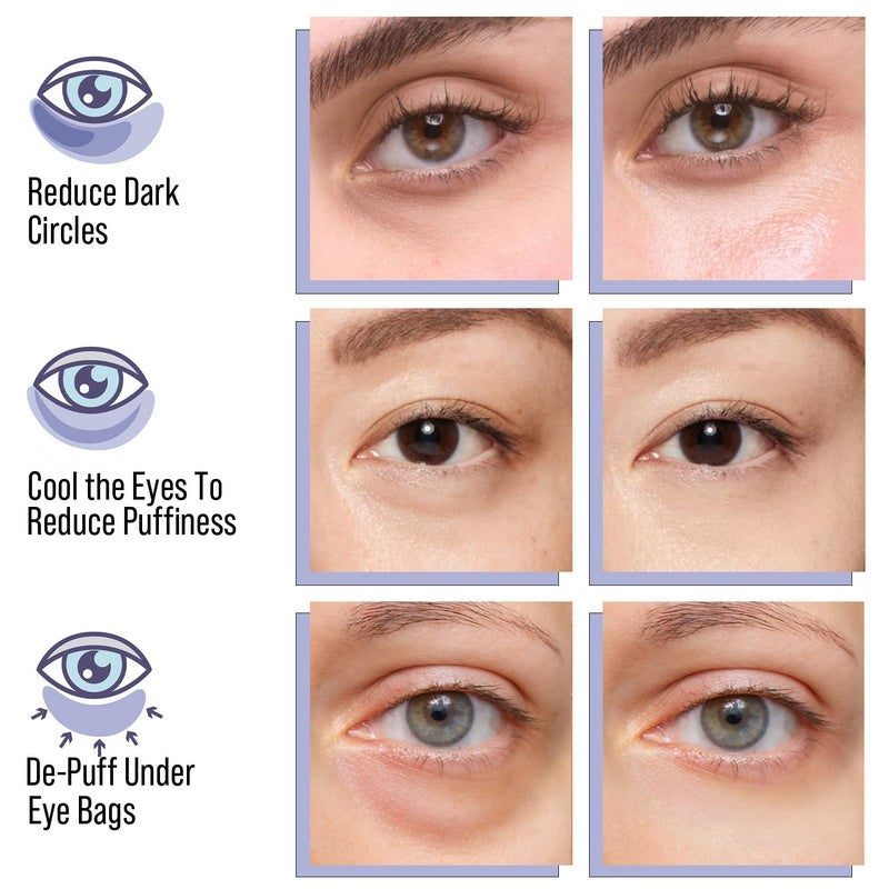 Tintark ULTIMATE HYDROGEL EYE MASK 28 Pairs Under Eye Patches Rejuvenate Eye Area Reduce Dark Circles Puffiness Tiredness Bags Gel Pads Brightening Plumps Fine Lines - Image 4