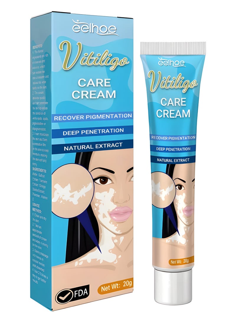 EELHOE كريم العناية بالبهاق 20 جرام