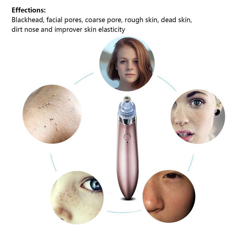 Spaceshoop Facial Pore Cleaner Blackhead Vacuum Suction Remover,Electric Facial Pore Cleanser Blackhead Remover Vacuum Suction Machine - Image 4