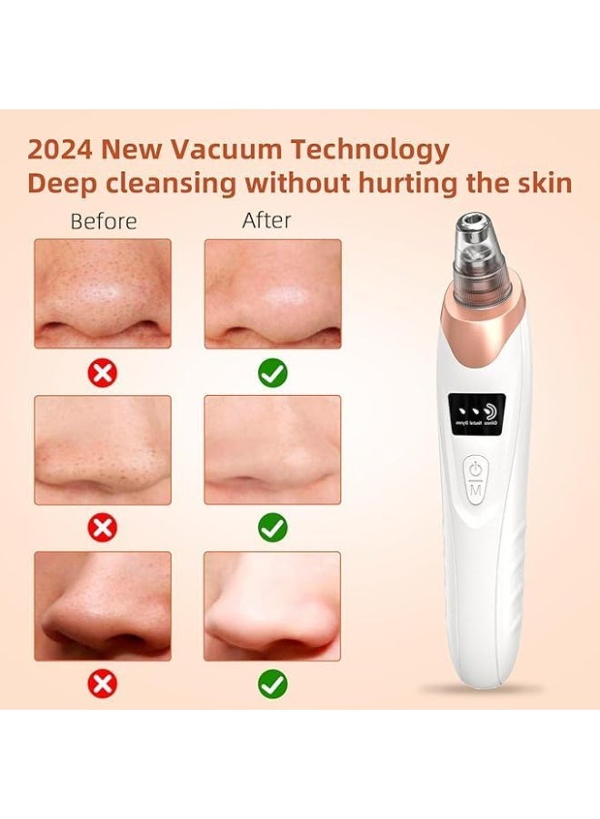 أداك مكنسة كهربائية لازالة الرؤوس السوداء 2025 من اداك - 5 مستويات شفط قابلة للتعديل + مجسات، منظف مسام الوجه قابل لاعادة الشحن بمنفذ USB، جهاز استخراج حب الشباب والعناية بالبشرة للبالغين (4 ادوات اضافية) - Image 2