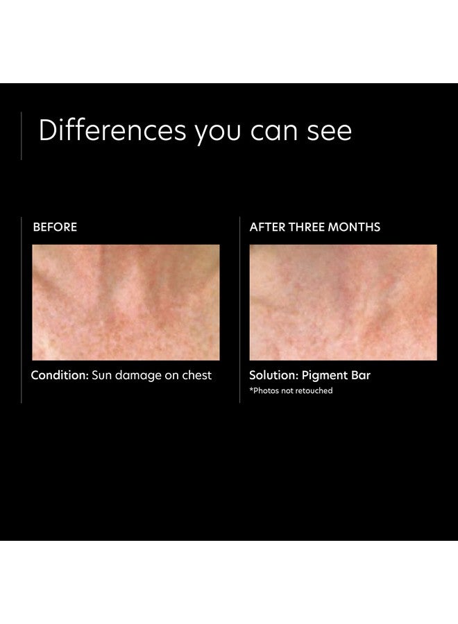 بي سي ايه سكين صابونة صبغة البشرة من PCA، صابونة فرط التصبغ للبقع الداكنة، مُصنّعة بحمض الأزيليك وحمض الكوجيك، عبوة سعة 3.2 أونصة سائلة - Image 4