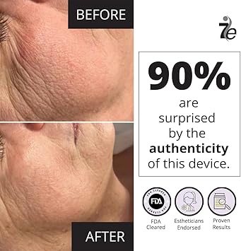 myolift 7E Myolift Face Lifting Device Mini Microcurrent Facial Device for Face Stimulation NonInvasive AntiAging Skin Tightening Esthetician Supplies Skin Care Tools - Image 4