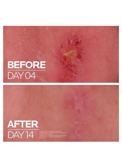 La Rochelle La Roche-Posay Cicaplast 100ml Baume B5+ Ultra Reparing Soothing Balm  - Image 3