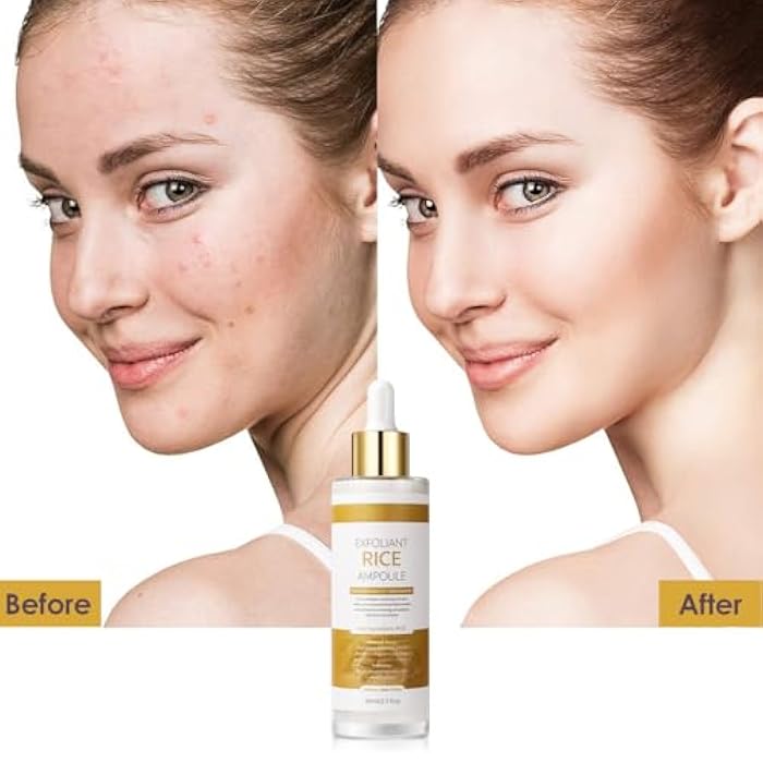 Veakoo Peel Shot Glow White Rice Exfoliant Peeling Ampoule, Soft Exfoliating Face and Body Scrub, Facial Exfoliator, Deep Hydration Serum, 80ml - Image 4