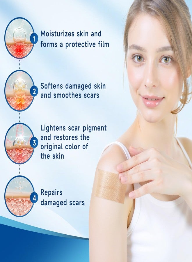 Rvlaim Silicone Scar Sheets, Silicone Scar Tape(1.8” x 157” Roll 4M), Silicone Scar Sheets for Surgical Scars, Keloid Bump Removal, Stretch Marks Removal, C-Section, Burn et - Image 5