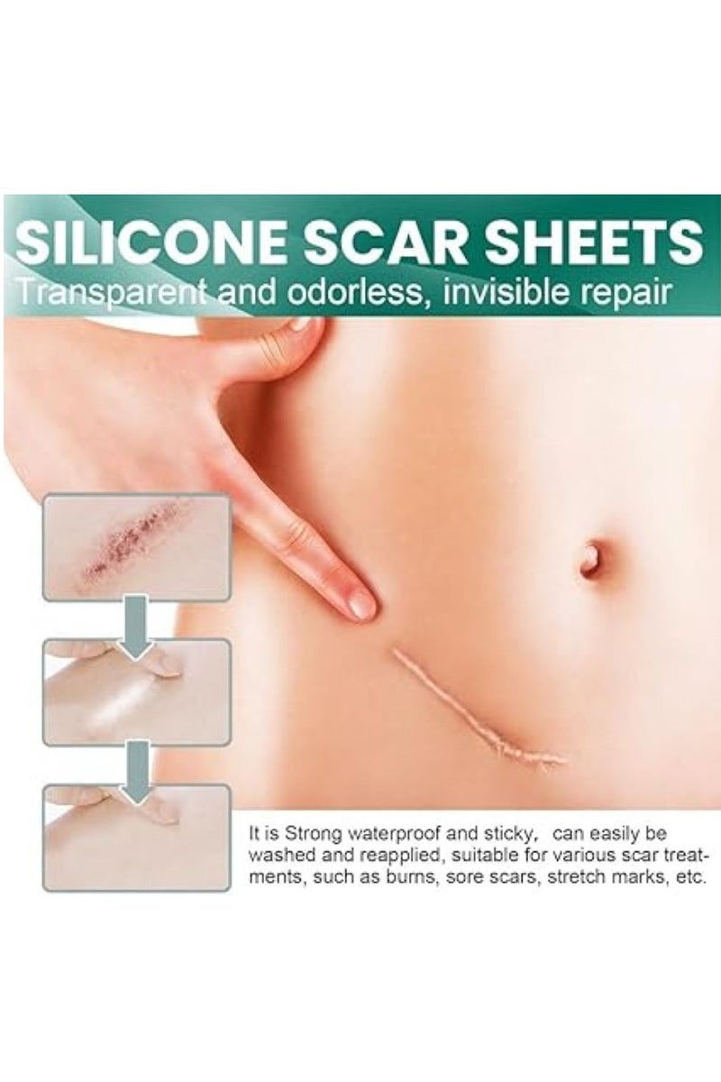 UREVO 2PCS Scar Repair Patch Silicone Scar Sheets,Extra Long Scar Sheets for C-Section, Tummy Tuck, Keloid, and Surgical Scars - Reusable Medical Grade Silicone Scar Tape - Image 2