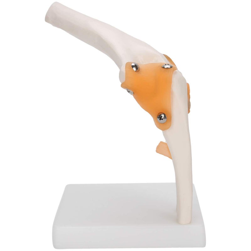 Life Size Elbow Joint Skeleton Model For Anatomy Study And Display - Image 3
