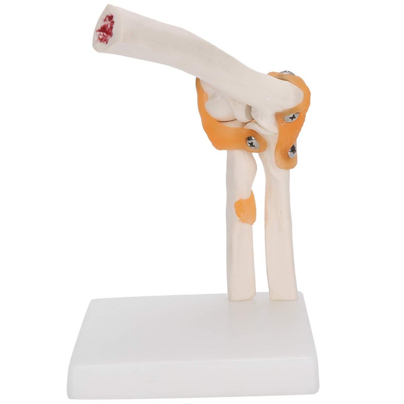 Life Size Elbow Joint Skeleton Model For Anatomy Study And Display - Image 2