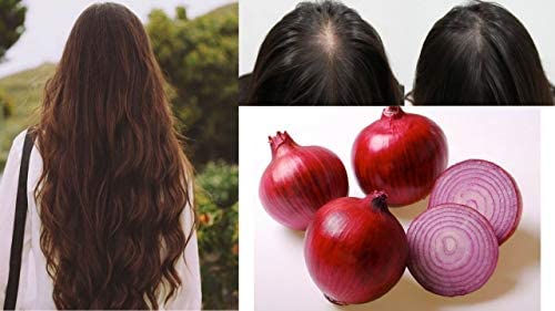 Khadi Rishikesh Herbal Onion Hair Growth Oil For Unisex-210ML,Control Hair Fall,-Daily Use Onion Hairoil For Hair Growth,WITH RUMAAL FREE - Image 3