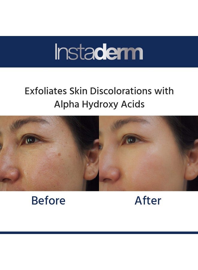 Instaderm Glycolic Acid 15% Anti-Aging Cream- Alpha Hydroxy Facial Moisturizer Reduces the Appearance of Fine Lines, Wrinkles, Age Spots, Dark Spots & Scars. Exfoliates & Smoothes Skin Texture & Tone. - Image 3